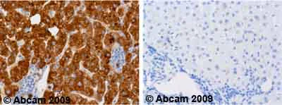Immunohistochemistry (Formalin/PFA-fixed paraffin-embedded sections) - Anti-alpha 1 Antitrypsin antibody [B9] (AB9399)
