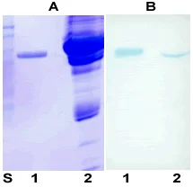 Western blot - Anti-alpha 1 Antitrypsin antibody [B9] (AB9399)