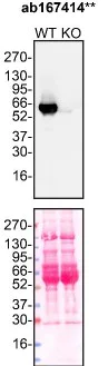 Western blot - Anti-alpha 1 Antitrypsin antibody [EPR10832(B)] (AB167414)