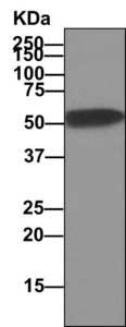 Immunoprecipitation - Anti-alpha 1 Antitrypsin antibody [EPR10832(B)] - BSA and Azide free (AB249427), expandable thumbnail