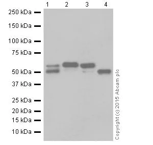 Western blot - Anti-alpha 1 Antitrypsin antibody [EPR17087-50] (AB207303)