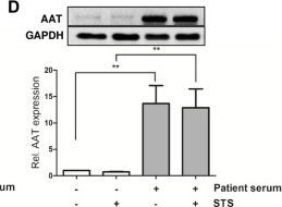 Western blot - Anti-alpha 1 Antitrypsin antibody [EPR17087-50] (AB207303)