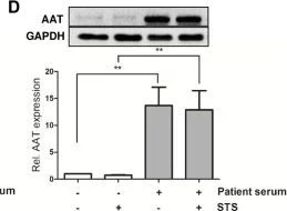 Western blot - Anti-alpha 1 Antitrypsin antibody [EPR17087-50] (AB207303)
