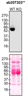 Western blot - Anti-alpha 1 Antitrypsin antibody [EPR17087-50] (AB207303)