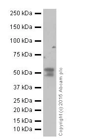 Western blot - Anti-alpha 1 Antitrypsin antibody [EPR17087-50] (AB207303)