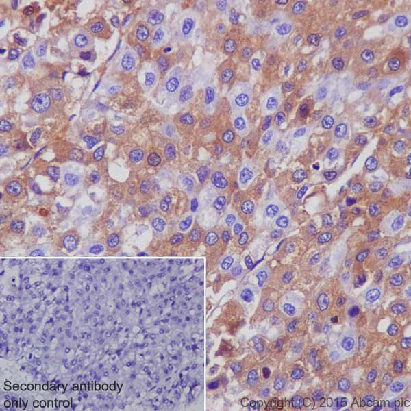 Immunohistochemistry (Formalin/PFA-fixed paraffin-embedded sections) - Anti-alpha 1 Antitrypsin antibody [EPR17087-50] - BSA and Azide free (AB240375)