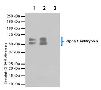 Immunoprecipitation - Anti-alpha 1 Antitrypsin antibody [EPR17087-50] - BSA and Azide free (AB240375)