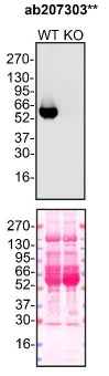 Western blot - Anti-alpha 1 Antitrypsin antibody [EPR17087-50] - BSA and Azide free (AB240375)