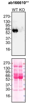 Western blot - Anti-alpha 1 Antitrypsin antibody [EPR9090] - BSA and Azide free (AB249351)