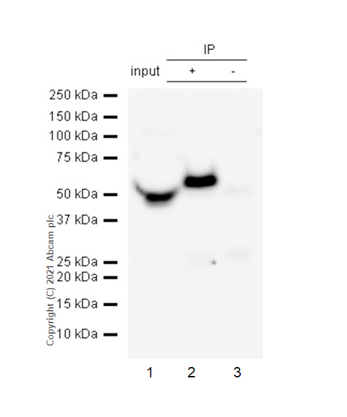 Immunoprecipitation - Anti-alpha 1 Antitrypsin antibody [EPSISR16] (AB133642)