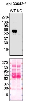 Western blot - Anti-alpha 1 Antitrypsin antibody [EPSISR16] (AB133642)