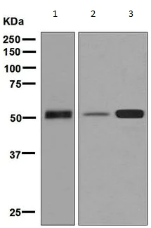 Western blot - Anti-alpha 1 Antitrypsin antibody [EPSISR16] - BSA and Azide free (AB226145)