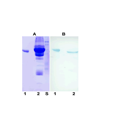Western blot - Anti-alpha 1 Antitrypsin antibody [G11] (AB9400)