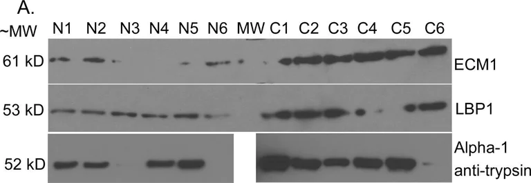 Western blot - Anti-alpha 1 Antitrypsin antibody [G11] (AB9400)