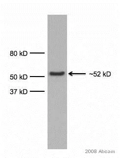 Western blot - Anti-alpha 1 Antitrypsin antibody [G11] (AB9400)