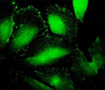 Immunocytochemistry/ Immunofluorescence - Anti-alpha 1 Fetoprotein antibody [1G7] (AB54745), expandable thumbnail