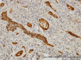 Immunohistochemistry (Formalin/PFA-fixed paraffin-embedded sections) - Anti-alpha 1 Fetoprotein antibody [1G7] (AB54745), expandable thumbnail