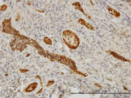 Immunohistochemistry (Formalin/PFA-fixed paraffin-embedded sections) - Anti-alpha 1 Fetoprotein antibody [1G7] (AB54745)