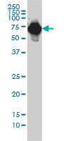 Western blot - Anti-alpha 1 Fetoprotein antibody [1G7] (AB54745), expandable thumbnail