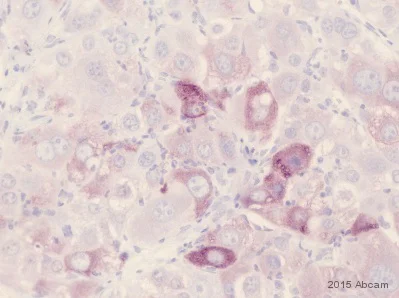 Immunohistochemistry (Formalin/PFA-fixed paraffin-embedded sections) - Anti-alpha 1 Fetoprotein antibody (AB46799)