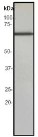 Western blot - Anti-alpha 1 Fetoprotein antibody (AB46799)