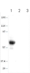 Western blot - Anti-alpha 1 Fetoprotein antibody (AB87635)