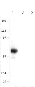 Western blot - Anti-alpha 1 Fetoprotein antibody (AB87635)