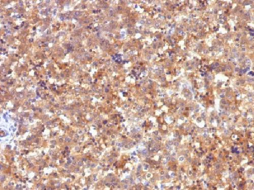 Immunohistochemistry (Formalin/PFA-fixed paraffin-embedded sections) - Anti-alpha 1 Fetoprotein antibody [C2] - BSA and Azide free (AB212325)