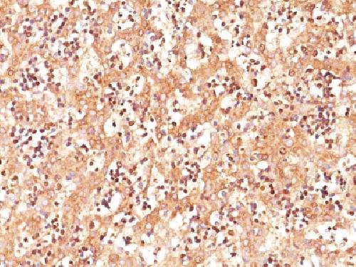 Immunohistochemistry (Formalin/PFA-fixed paraffin-embedded sections) - Anti-alpha 1 Fetoprotein antibody [C3] - BSA and Azide free (AB212320)