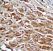 Immunohistochemistry (Formalin/PFA-fixed paraffin-embedded sections) - Anti-alpha 1 Fetoprotein antibody [EP1017Y] - BSA and Azide free (AB240506), expandable thumbnail