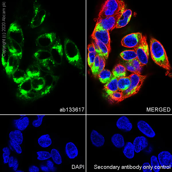 Immunocytochemistry/ Immunofluorescence - Anti-alpha 1 Fetoprotein antibody [EPAFP61] (AB133617)