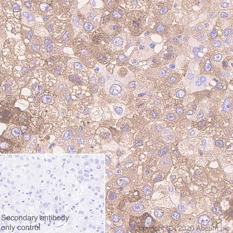 Immunohistochemistry (Formalin/PFA-fixed paraffin-embedded sections) - Anti-alpha 1 Fetoprotein antibody [EPAFP61] (AB133617)