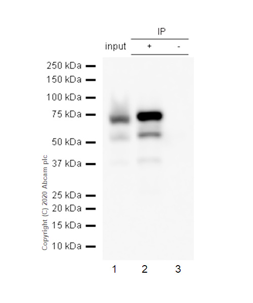 Immunoprecipitation - Anti-alpha 1 Fetoprotein antibody [EPAFP61] (AB133617), expandable thumbnail