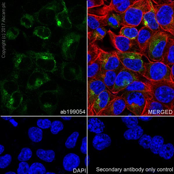 Immunocytochemistry/ Immunofluorescence - Anti-alpha 1 Fetoprotein antibody [EPR19240-133] (AB199054), expandable thumbnail