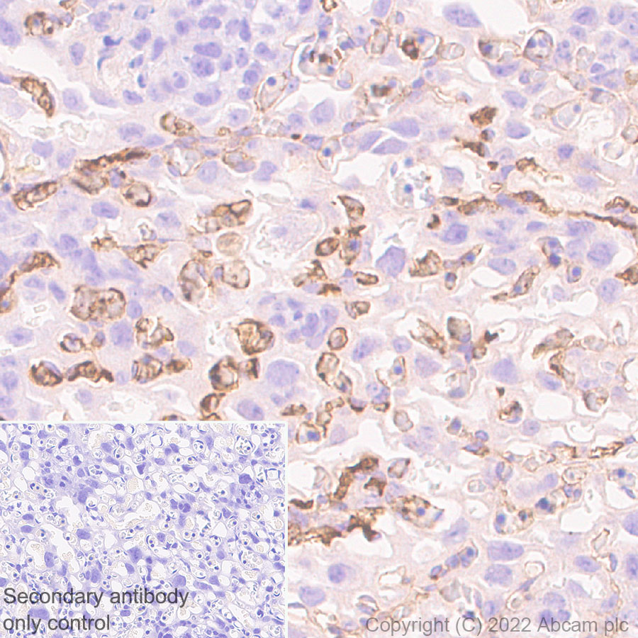 Immunohistochemistry (Formalin/PFA-fixed paraffin-embedded sections) - Anti-alpha 1 Fetoprotein antibody [EPR26548-19] (AB290637), expandable thumbnail