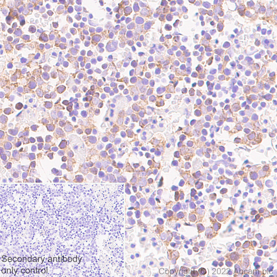 Immunohistochemistry (Formalin/PFA-fixed paraffin-embedded sections) - Anti-alpha 1 Fetoprotein antibody [EPR26548-19] (AB290637), expandable thumbnail