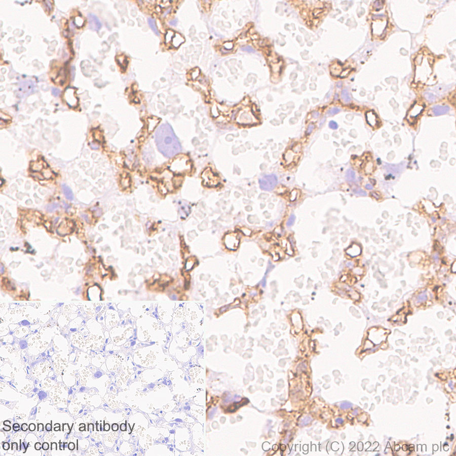 Immunohistochemistry (Formalin/PFA-fixed paraffin-embedded sections) - Anti-alpha 1 Fetoprotein antibody [EPR26548-19] (AB290637), expandable thumbnail