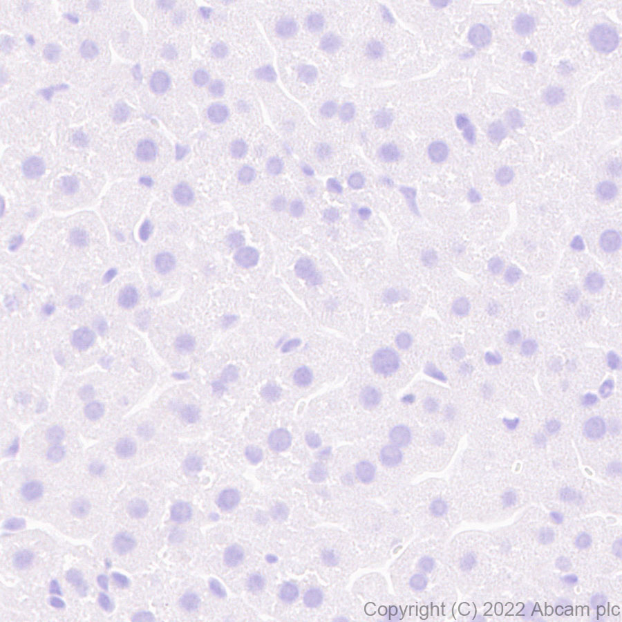 Immunohistochemistry (Formalin/PFA-fixed paraffin-embedded sections) - Anti-alpha 1 Fetoprotein antibody [EPR26548-19] (ab290637), expandable thumbnail