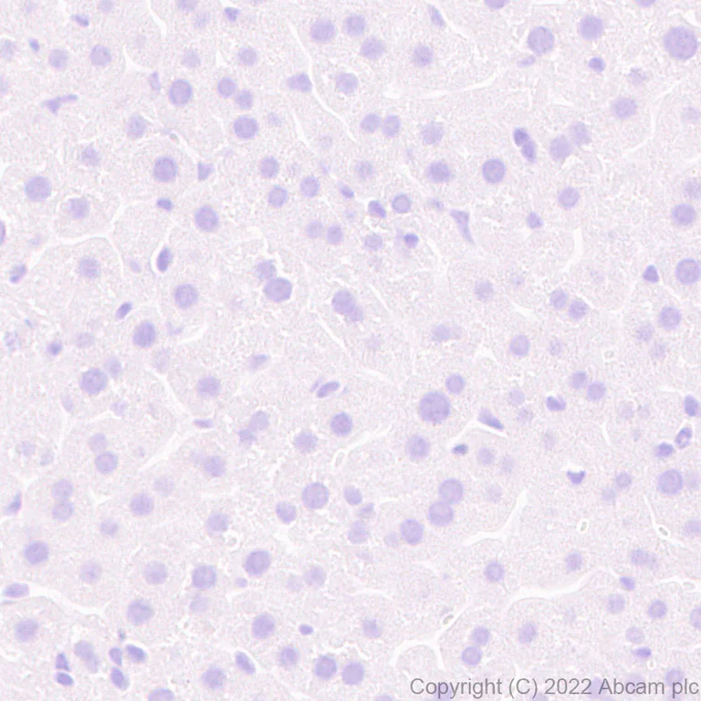 Immunohistochemistry (Formalin/PFA-fixed paraffin-embedded sections) - Anti-alpha 1 Fetoprotein antibody [EPR26548-19] (AB290637)