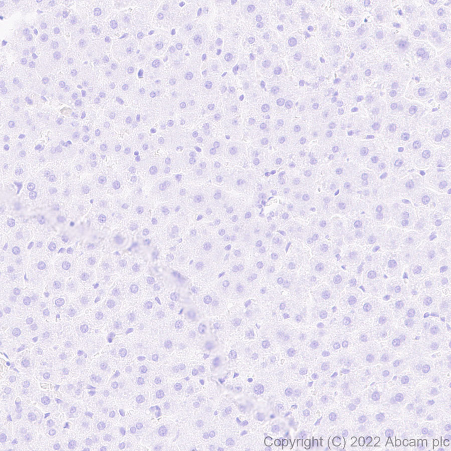 Immunohistochemistry (Formalin/PFA-fixed paraffin-embedded sections) - Anti-alpha 1 Fetoprotein antibody [EPR26548-19] (ab290637), expandable thumbnail