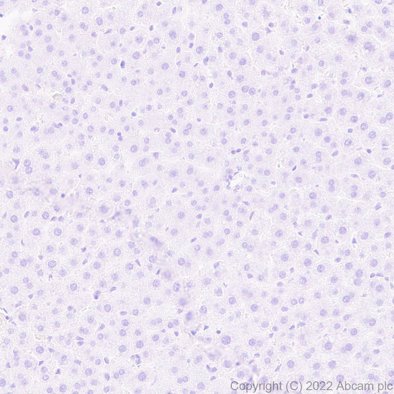 Immunohistochemistry (Formalin/PFA-fixed paraffin-embedded sections) - Anti-alpha 1 Fetoprotein antibody [EPR26548-19] (AB290637)