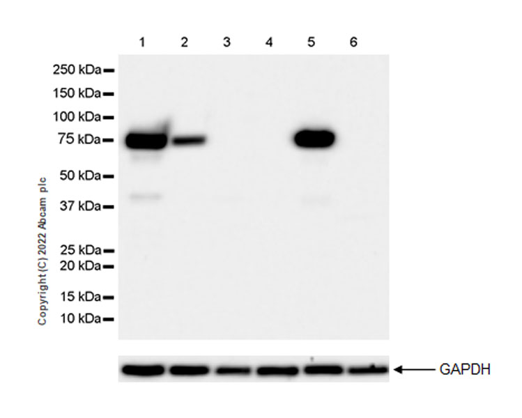 Western blot - Anti-alpha 1 Fetoprotein antibody [EPR26548-19] (AB290637), expandable thumbnail