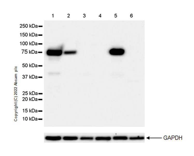 Western blot - Anti-alpha 1 Fetoprotein antibody [EPR26548-19] (AB290637)