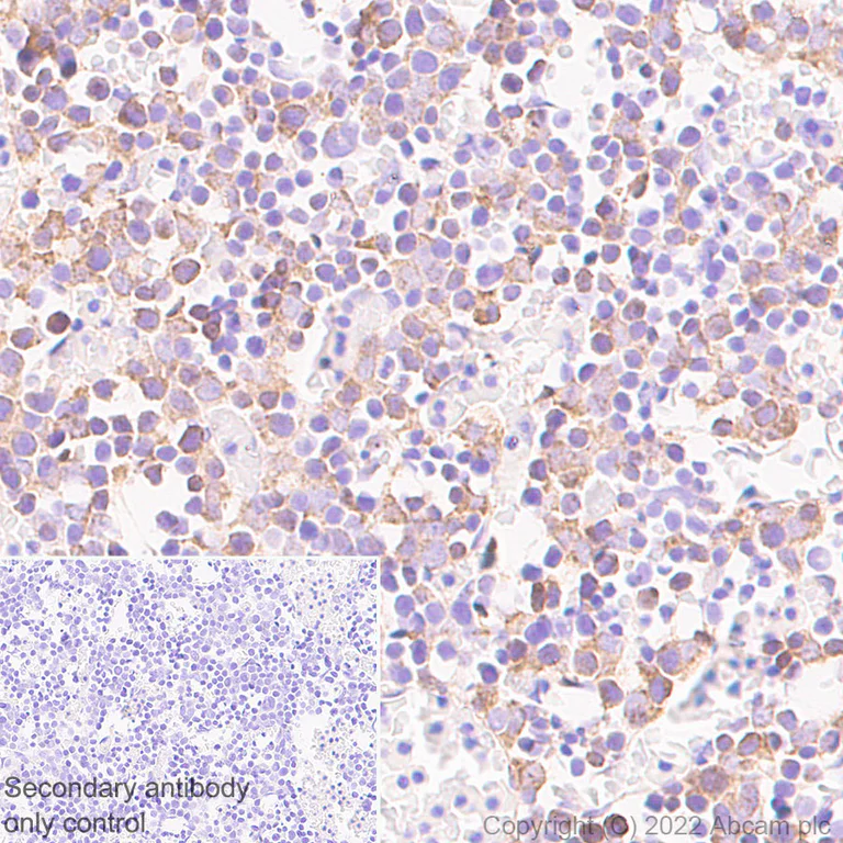 Immunohistochemistry (Formalin/PFA-fixed paraffin-embedded sections) - Anti-alpha 1 Fetoprotein antibody [EPR26548-19] - BSA and Azide free (AB290648)