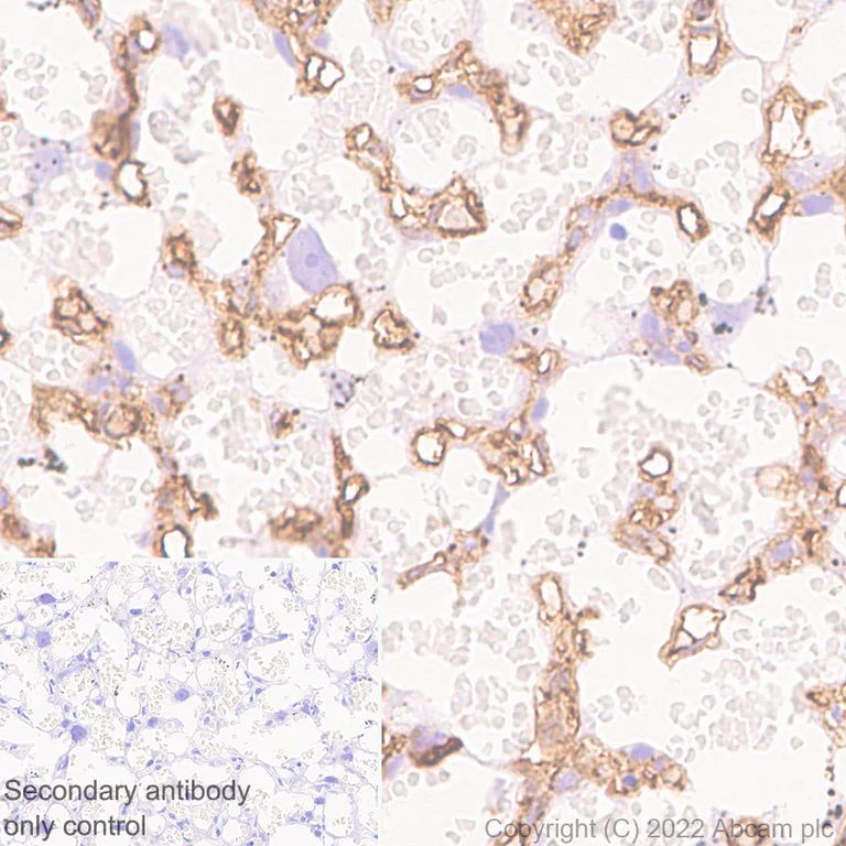 Immunohistochemistry (Formalin/PFA-fixed paraffin-embedded sections) - Anti-alpha 1 Fetoprotein antibody [EPR26548-19] - BSA and Azide free (AB290648)