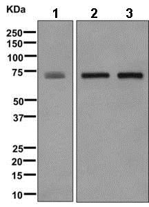 Western blot - Anti-alpha 1 Fetoprotein antibody [EPR9309] (AB169552)