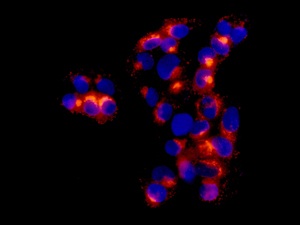 Immunocytochemistry/ Immunofluorescence - Anti-alpha 1 Fetoprotein antibody [EPR9309] - BSA and Azide free (AB188828), expandable thumbnail