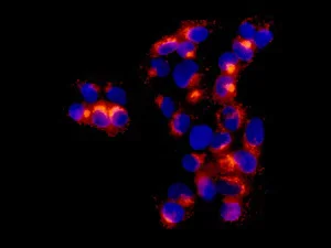 Immunocytochemistry/ Immunofluorescence - Anti-alpha 1 Fetoprotein antibody [EPR9309] - BSA and Azide free (AB188828)
