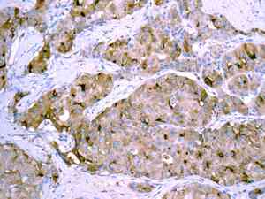Immunohistochemistry (Formalin/PFA-fixed paraffin-embedded sections) - Anti-alpha 1 Fetoprotein antibody [EPR9309] - BSA and Azide free (AB188828), expandable thumbnail