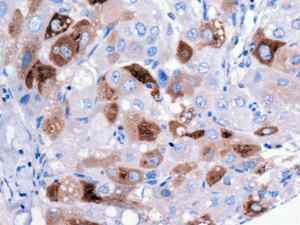 Immunohistochemistry (Formalin/PFA-fixed paraffin-embedded sections) - Anti-alpha 1 Fetoprotein antibody [EPR9309] - BSA and Azide free (AB188828), expandable thumbnail